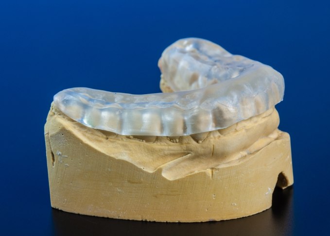 Model of the jaw with a clear nightguard over the teeth